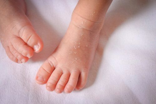 Mách mẹ những tips chăm sóc làn da trẻ sơ sinh hình 4