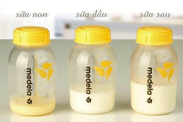 Bí quyết giúp mẹ chọn sữa non cho trẻ sơ sinh hình 1